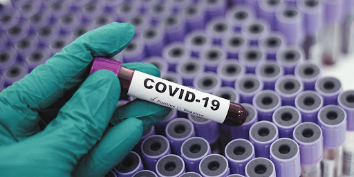 Update regarding the IΕΝΕ and Covid-19